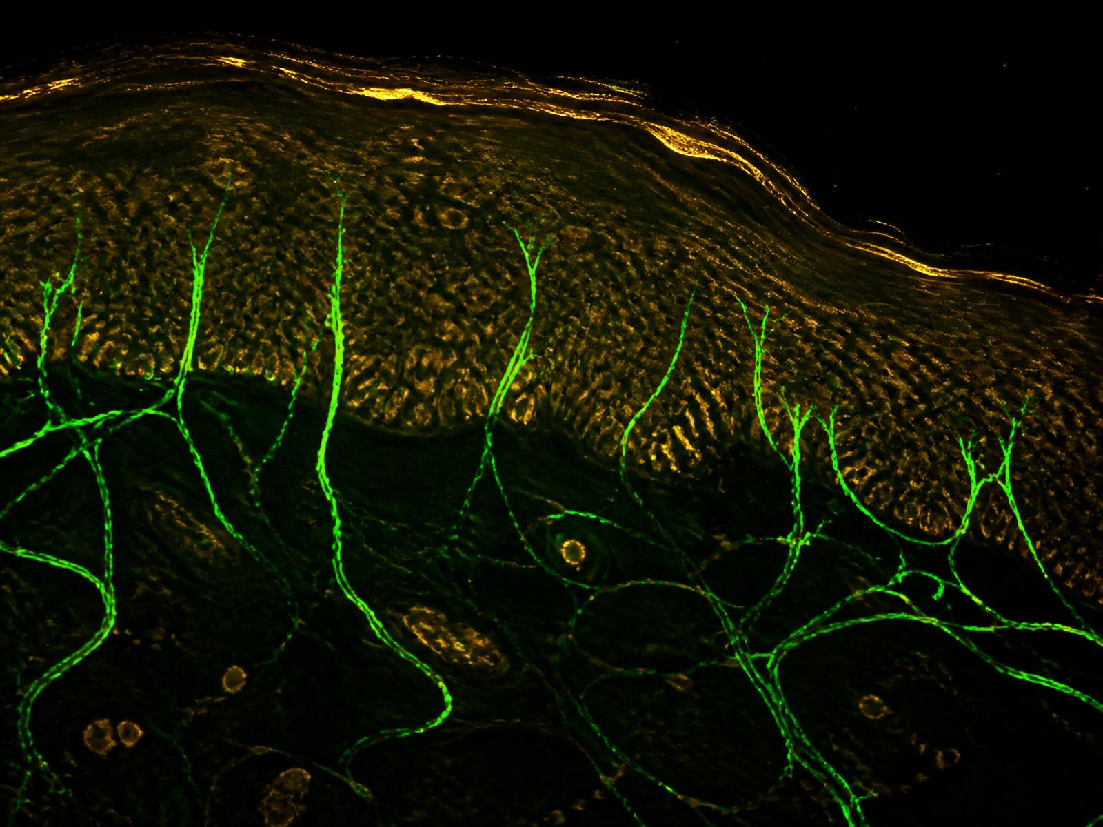 Immunofluorescence microscopy of epidermal nerve fibers